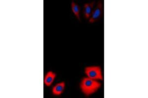 Immunofluorescent analysis of MARK2 staining in Jurkat cells. (MARK2 antibody  (N-Term))