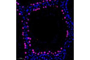 Immunofluorescence (Paraffin-embedded Sections) (IF (p)) image for anti-Mediator Complex Subunit 8 (MED8) antibody (ABIN7074582)
