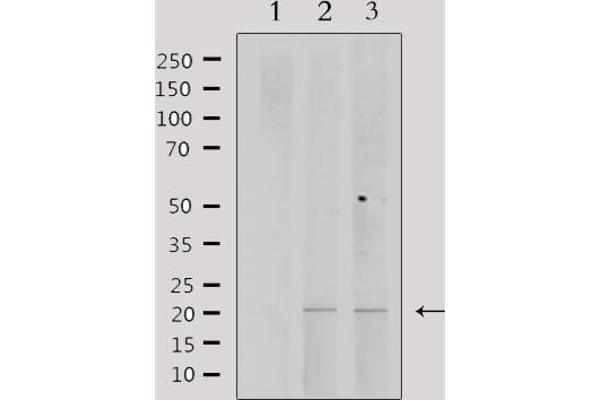PPP1R14C antibody  (Internal Region)