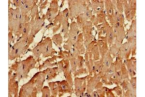 Immunohistochemistry of paraffin-embedded human heart tissue using ABIN7147850 at dilution of 1:100