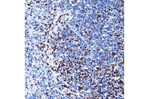 Immunohistochemistry of paraffin-embedded mouse spleen using Acetyl-Histone H2B-K5 antibody (ABIN7267733) at dilution of 1:100 (40x lens). (Histone H2B antibody  (acLys5))