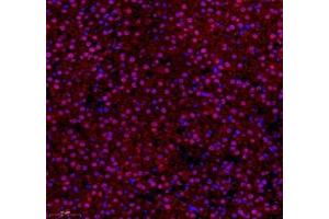 Immunofluorescence of paraffin embedded rat adrenal gland using ZNF295 (ABIN7076264) at dilution of 1: 650 (250x lens) (ZNF295 antibody)