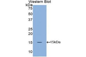 Western blot analysis of the recombinant protein. (Angiopoietin 1 antibody  (AA 148-266))