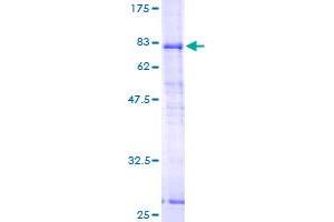 SRPX Protein (AA 31-464) (GST tag)