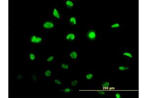 Immunofluorescence of monoclonal antibody to ID1 on HeLa cell. (ID1 antibody  (AA 1-155))