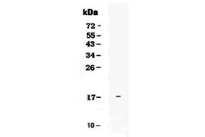 Western blot analysis of IL17E using anti-IL17E antibody . (IL-25 antibody  (AA 33-177))