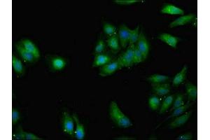 Immunofluorescent analysis of Hela cells using ABIN7154376 at dilution of 1:100 and Alexa Fluor 488-congugated AffiniPure Goat Anti-Rabbit IgG(H+L) (GRHL2 antibody  (AA 1-265))