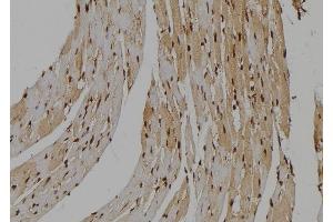ABIN6263656 and ABIN6277487 at 1/100 staining Mouse heart tissue by IHC-P. (Nemo-Like Kinase antibody  (N-Term))