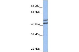 GALT antibody used at 1 ug/ml to detect target protein.