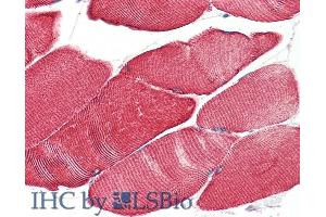 Immunohistochemistry (IHC) image for anti-Desmin (DES) (C-Term) antibody (ABIN334386)