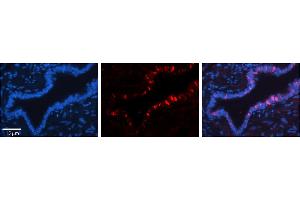 Rabbit Anti-XPOT Antibody     Formalin Fixed Paraffin Embedded Tissue: Human Bronchial Epithelial Tissue  Observed Staining: Cytoplasmic and nuclear  Primary Antibody Concentration: 1:100  Other Working Concentrations: 1/600  Secondary Antibody: Donkey anti-Rabbit-Cy3  Secondary Antibody Concentration: 1:200  Magnification: 20X  Exposure Time: 0. (XPOT antibody  (Middle Region))