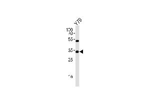 Western blot analysis of lysate from Y79 cell line, using OTX2 Antibody (Center) (ABIN6243699 and ABIN6577613). (OTX2 antibody  (AA 102-135))