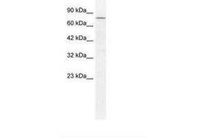 DDX23 antibody  (C-Term)