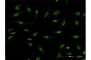 Immunofluorescence of monoclonal antibody to DIDO1 on HeLa cell. (DIDO1 antibody  (AA 321-420))