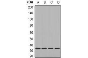 Western blot analysis of LACI expression in HEK293T (A), MCF7 (B), mouse lung (C), mouse heart (D) whole cell lysates. (LacI antibody)