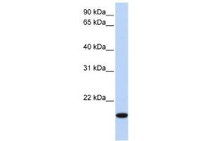 EVX2 antibody used at 0. (EVX2 antibody  (N-Term))