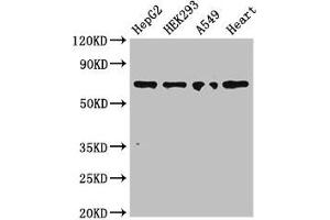 Western Blot Positive WB detected in: HepG2 whole cell lysate, HEK293 whole cell lysate, A549 whole cell lysate, Mouse heart tissue All lanes: TRIM5 antibody at 3 μg/mL Secondary Goat polyclonal to rabbit IgG at 1/50000 dilution Predicted band size: 57, 47, 41, 38, 32, 30 kDa Observed band size: 70 kDa (TRIM5 antibody  (AA 1-493))