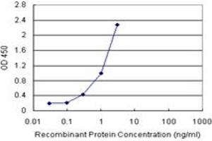 Sandwich ELISA detection sensitivity ranging from 0. (NNMT (Human) Matched Antibody Pair)