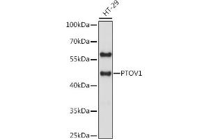 Western blot analysis of extracts of HT-29 cells, using PTOV1 antibody (ABIN7269578) at 1:1000 dilution. (PTOV1 antibody  (AA 1-100))