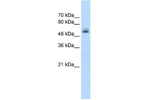 WB Suggested Anti-PRPF19 Antibody Titration:  1.