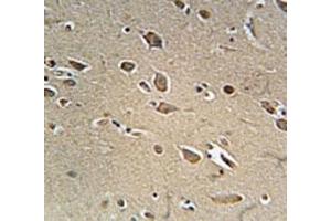 Immunohistochemistry (IHC) image for anti-Nerve Growth Factor Receptor (NGFR) antibody (ABIN3031960)