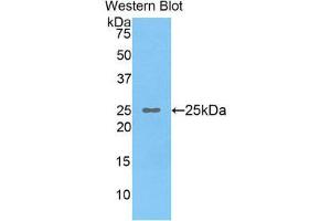 Western Blotting (WB) image for anti-Osteoclast Stimulating Factor 1 (OSTF1) (AA 12-214) antibody (ABIN1860106)