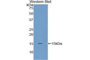 Detection of Recombinant S100A9, Mouse using Polyclonal Antibody to S100 Calcium Binding Protein A9 (S100A9) (S100A9 antibody  (AA 1-113))