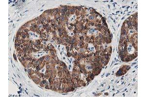 Image no. 3 for anti-Leucine Carboxyl Methyltransferase 1 (LCMT1) antibody (ABIN1499107) (LCMT1 antibody)