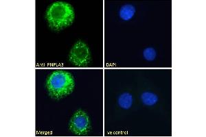 Immunofluorescence (IF) image for anti-Patatin-Like phospholipase Domain Containing 3 (PNPLA3) (Internal Region) antibody (ABIN361184)