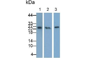 Western Blotting (WB) image for anti-Tumor Necrosis Factor Receptor Superfamily, Member 1A (TNFRSF1A) (AA 248-428) antibody (ABIN7442288)
