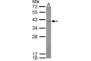 Western Blotting (WB) image for anti-Kallikrein 11 (KLK11) antibody (ABIN2855789)