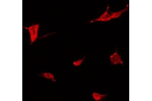 ABIN6266806 staining COLO205 by IF/ICC. (Meningioma 1 antibody  (Internal Region))