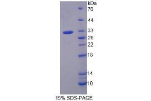 Image no. 1 for Guanine Nucleotide Binding Protein (G Protein), beta Polypeptide 3 (GNB3) (AA 1-257) protein (His tag) (ABIN6239658)