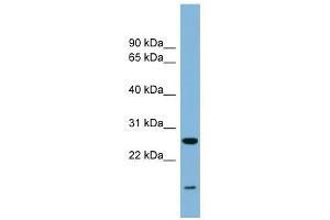 TRAPPC4 antibody used at 0. (TRAPPC4 antibody  (Middle Region))