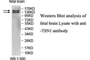 Image no. 1 for anti-Intersectin 1 (ITSN1) antibody (ABIN1577370) (ITSN1 antibody)