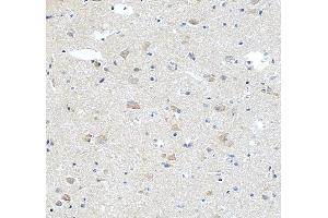 IHC analysis of STK24 using anti-STK24 antibody (ABIN7599389). (STK24 antibody  (AA 1-433))