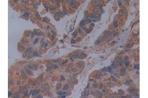 Used in DAB staining on fromalin fixed paraffin- embedded breast cancer tissue (Cadherin 4 antibody  (AA 667-916))