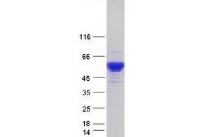 Validation with Western Blot (SERPINA1 Protein (Transcript Variant 10) (Myc-DYKDDDDK Tag))