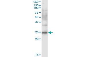 Immunoprecipitation of CD8B transfected lysate using anti-CD8B MaxPab rabbit polyclonal antibody and Protein A Magnetic Bead , and immunoblotted with CD8B purified MaxPab mouse polyclonal antibody (B01P) . (CD8B antibody  (AA 1-243))