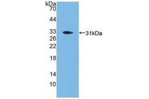 Detection of Recombinant PCSK1, Human using Polyclonal Antibody to Proprotein Convertase Subtilisin/Kexin Type 1 (PCSK1) (PCSK1 antibody  (AA 500-738))