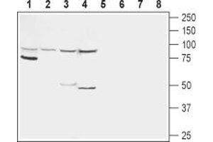 Western blot analysis of rat kidney (lanes 1 and 5), rat liver (lanes 2 and 6), mouse liver (lanes 3 and 7) and human HepG2 liver carcinoma cell line (lanes 4 and 8) lysates:  - 1-4. (Glucagon Receptor antibody  (1st Extracellular Loop))