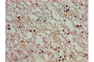 Immunohistochemistry of paraffin-embedded human brain tissue using ABIN7146404 at dilution of 1:100 (ATP2C1 antibody  (AA 491-605))