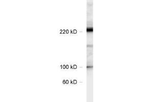 dilution: 1 : 1000, sample: rat hippocampus lysate