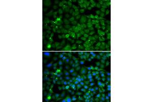 Immunofluorescence analysis of MCF-7 cells using SMYD4 antibody. (SMYD4 antibody  (AA 1-260))