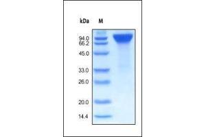 Human EGF R, Fc Tag on SDS-PAGE under reducing (R) condition. (EGFR Protein (AA 25-645) (Fc Tag))