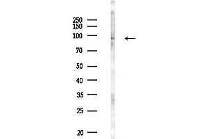 anti-Protein Associated with Topoisomerase II Homolog 1 (PATL1) antibody