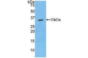 Detection of Recombinant ITGb1, Mouse using Polyclonal Antibody to Integrin Beta 1 (ITGb1) (ITGB1 antibody  (AA 454-714))