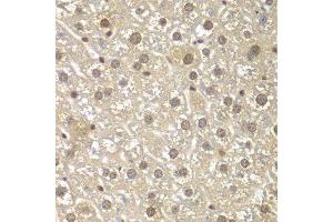 Immunohistochemistry of paraffin-embedded mouse liver using MAD1L1 antibody. (MAD1L1 antibody  (AA 360-700))