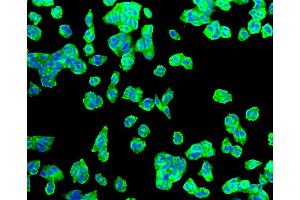 Immunofluorescence analysis of HeLa cells using SLC2A1 antibody (ABIN5997113).