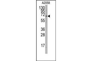 Image no. 1 for anti-RAR-Related Orphan Receptor A (RORA) antibody (ABIN356632) (RORA antibody)